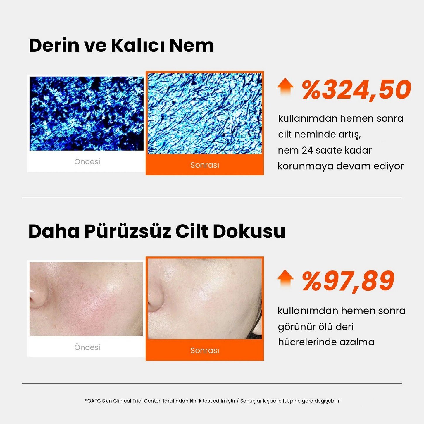 Genabelle PDRN Enriched Recovery Balm – PDRN İçeren Yoğun Bariyer Onarıcı ve Yatıştırıcı Balm Krem 50ml