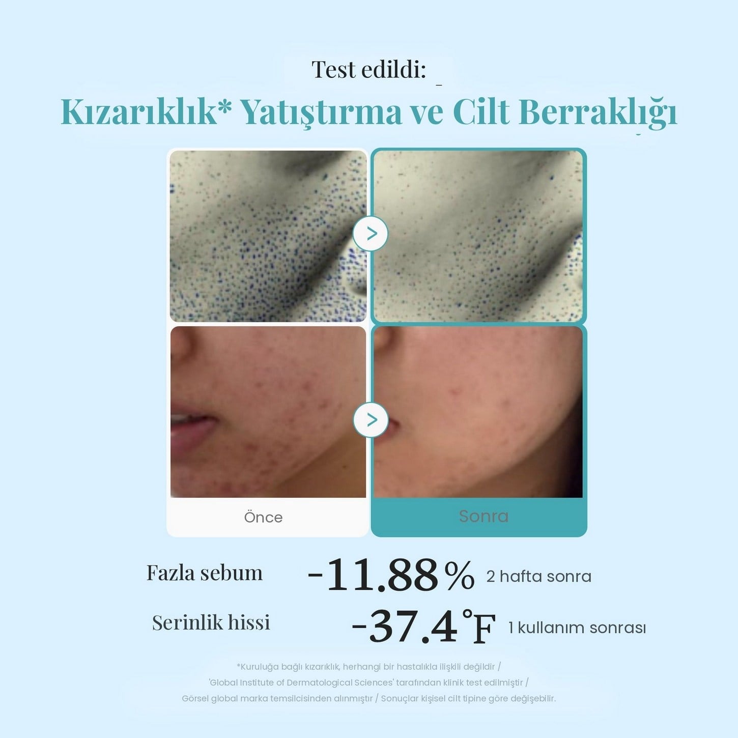 Medicube Azelaic Acid Niacinamide Clear Toner – Arındırıcı Dengeleyici Tonik 250ml