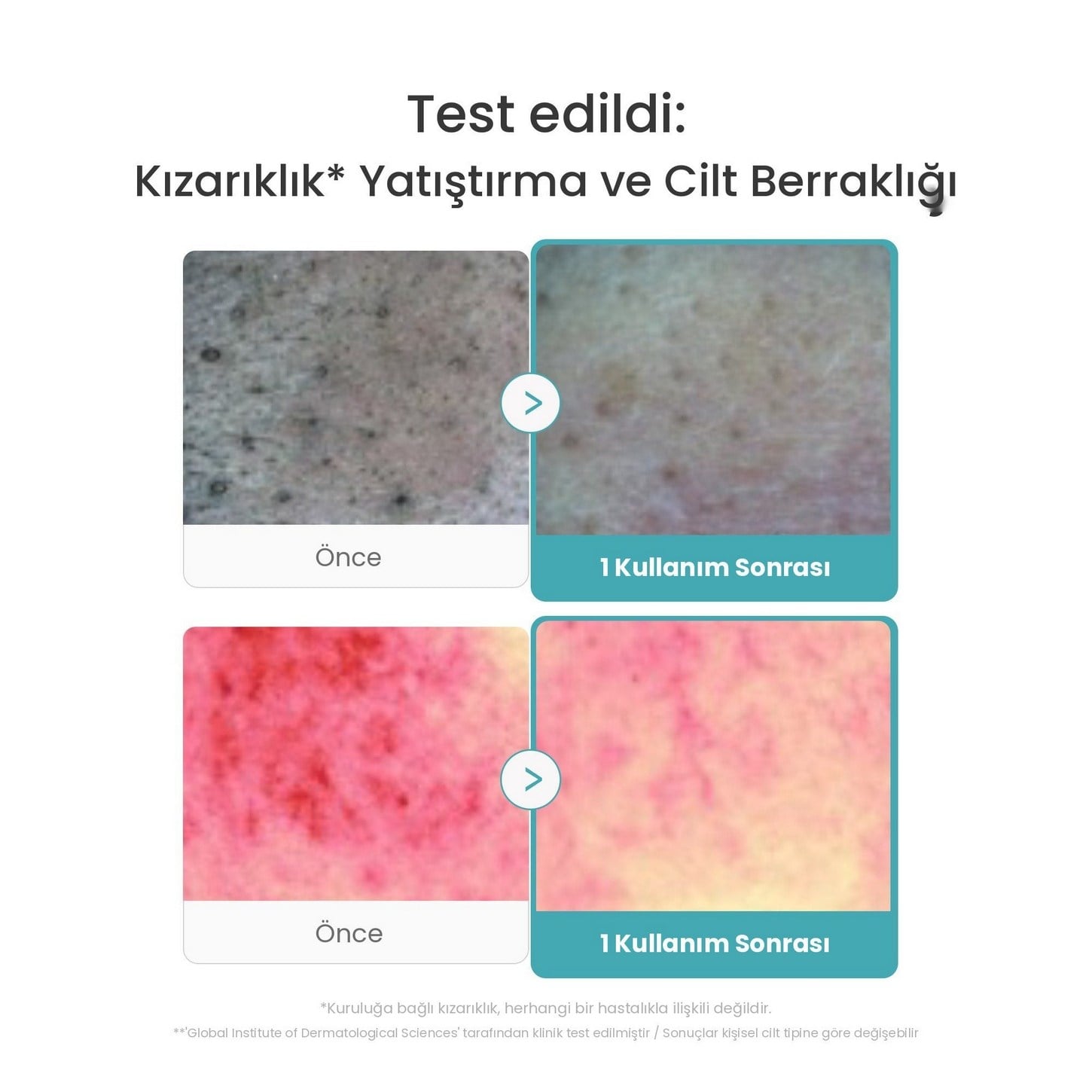 Medicube Azelaic Acid Niacinamide Deep Clean Foam Cleanser – Arındırıcı Köpük Temizleyici 120g