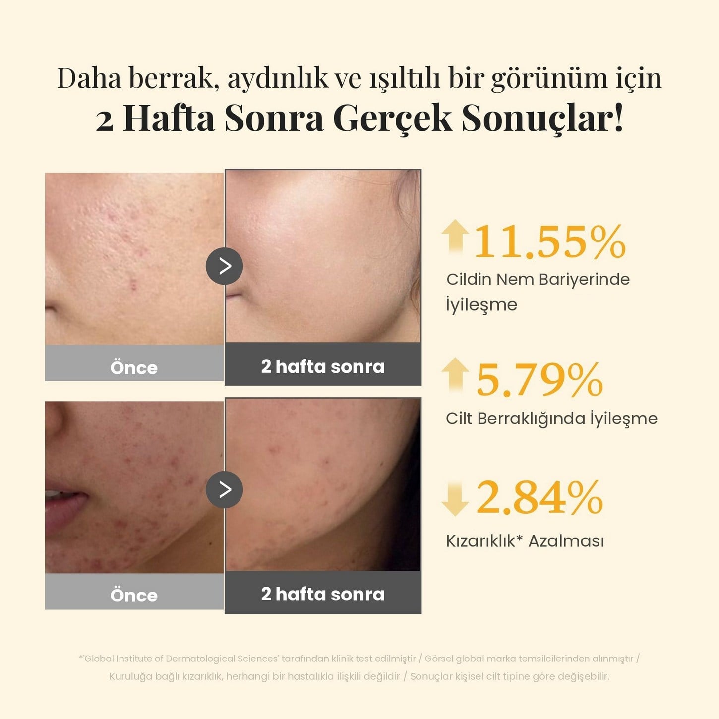 Medicube Kojic Acid Turmeric Niacinamide Serum– Leke Karşıtı Aydınlatıcı Serum 30ml