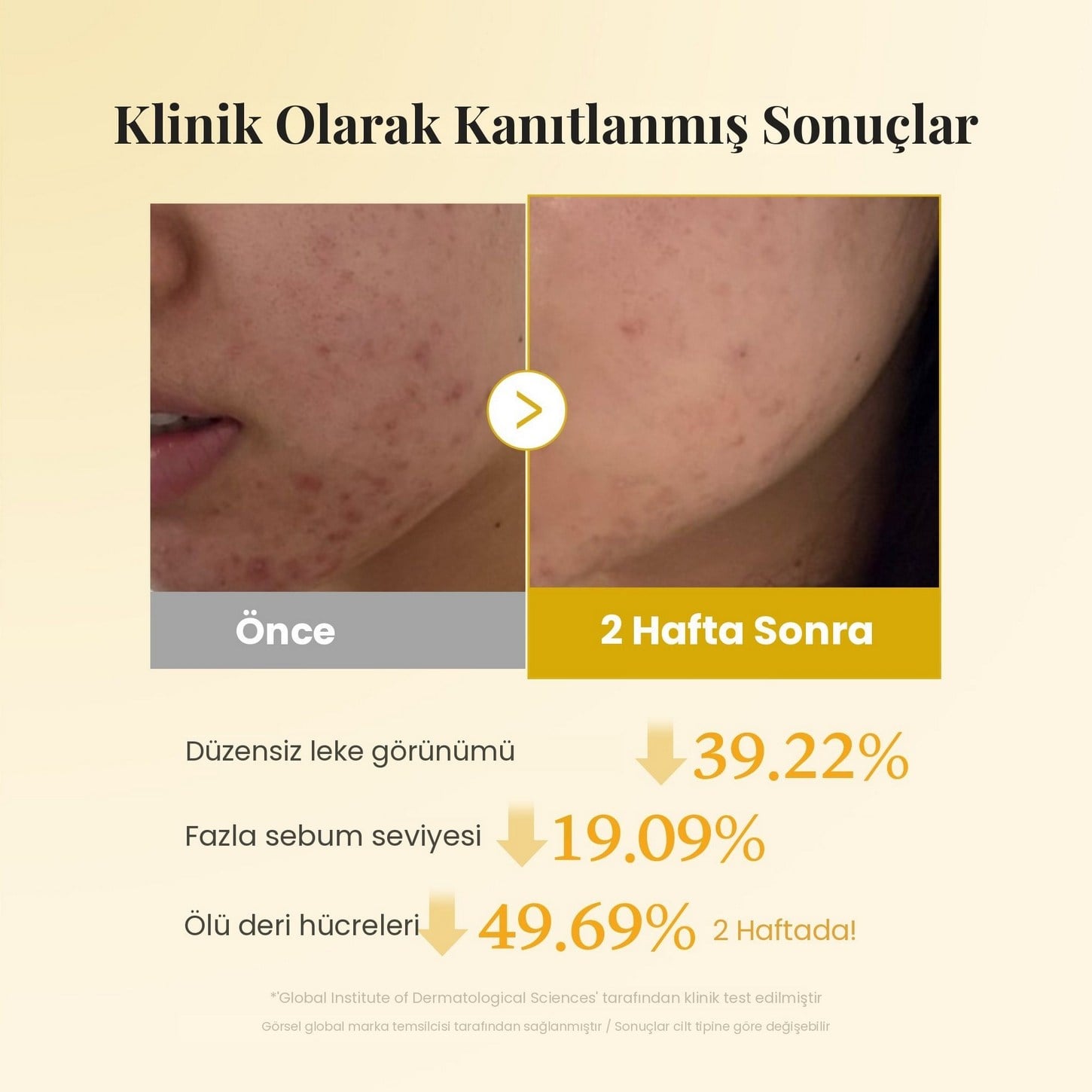 Medicube Kojic Acid Turmeric Pad – Kojik Asit ve Zerdeçal İçeren Leke Karşıtı Aydınlatıcı Ped 70pcs
