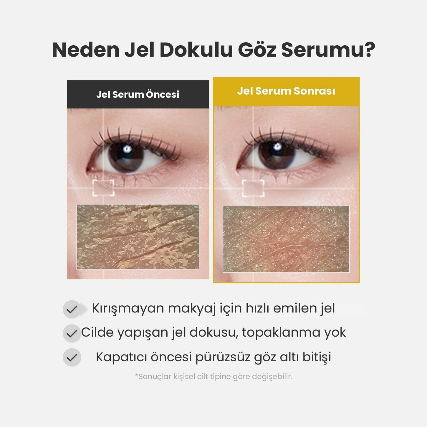 Medicube Kojic Acid Turmeric Vita Eye Gel Serum – Aydınlatıcı Göz Çevresi Jel Serum 30ml