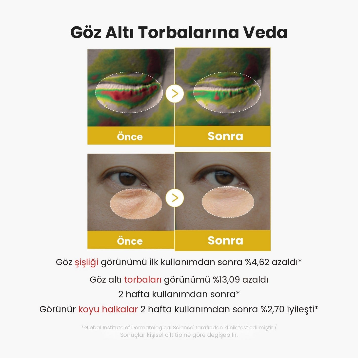 Medicube Kojic Acid Turmeric Vita Eye Gel Serum – Aydınlatıcı Göz Çevresi Jel Serum 30ml