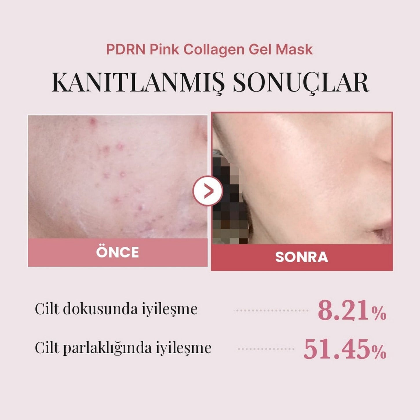 Medicube PDRN Pink Collagen Gel Mask (4 Adet) – Sıkılaştırıcı Kolajen Jel Maske 4ea