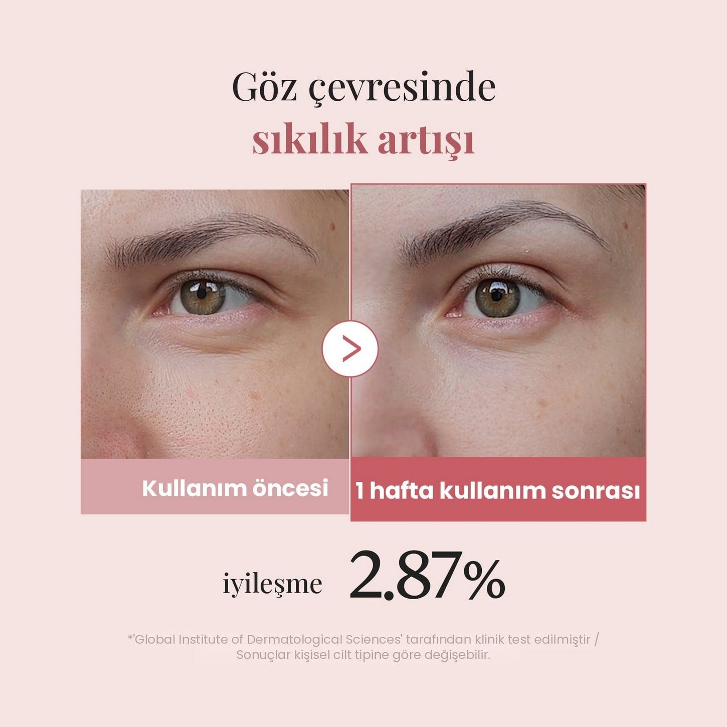 Medicube PDRN Pink Peptide Eye Cream – PDRN ve Peptit İçerikli Sıkılaştırıcı Göz Çevresi Kremi 30ml