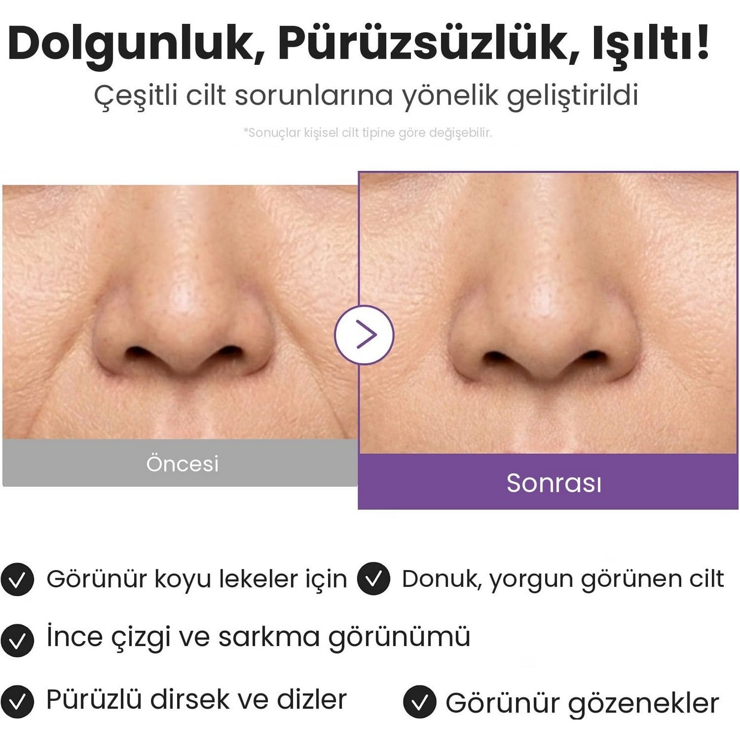 Medicube Retinol NMN Boosting Serum – Saf Retinol ve NMN İçeren Yaşlanma Karşıtı Hücre Yenileyici Serum 30ml