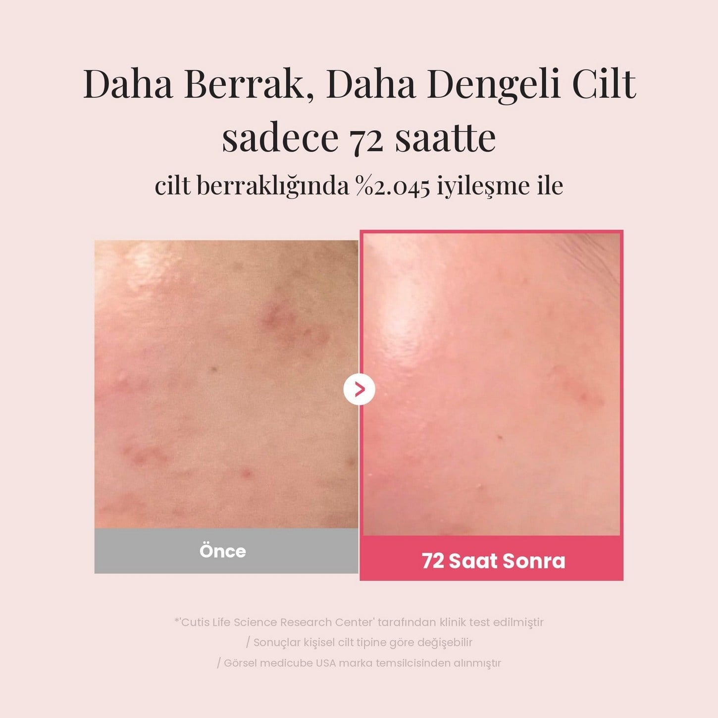 Medicube TXA Niacinamide 15 Serum – Traneksamik Asit ve Niasinamid İçeren Yüksek Konsantre Leke Serumu 30ml