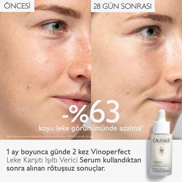 Caudalie Vinoperfect Leke Karşıtı Işıltı Verici Serum 30 ml