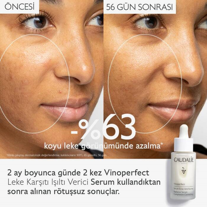 Caudalie Vinoperfect Leke Karşıtı Işıltı Verici Serum 30 ml