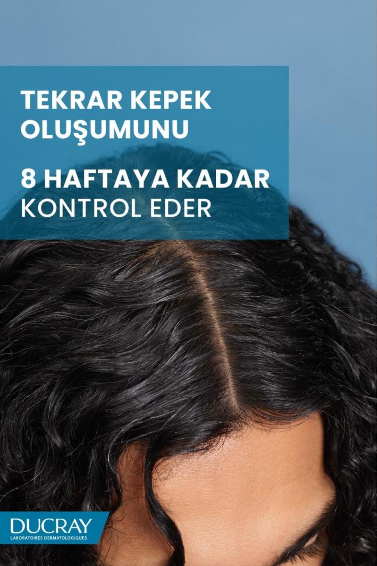 Ducray Kelual Squanorm Yağlı Şaçlar için 400 ml Kepek Şampuanı