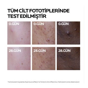 la-roche-posay-effaclar-duo-m-cilt-kus-78b2e2.jpg