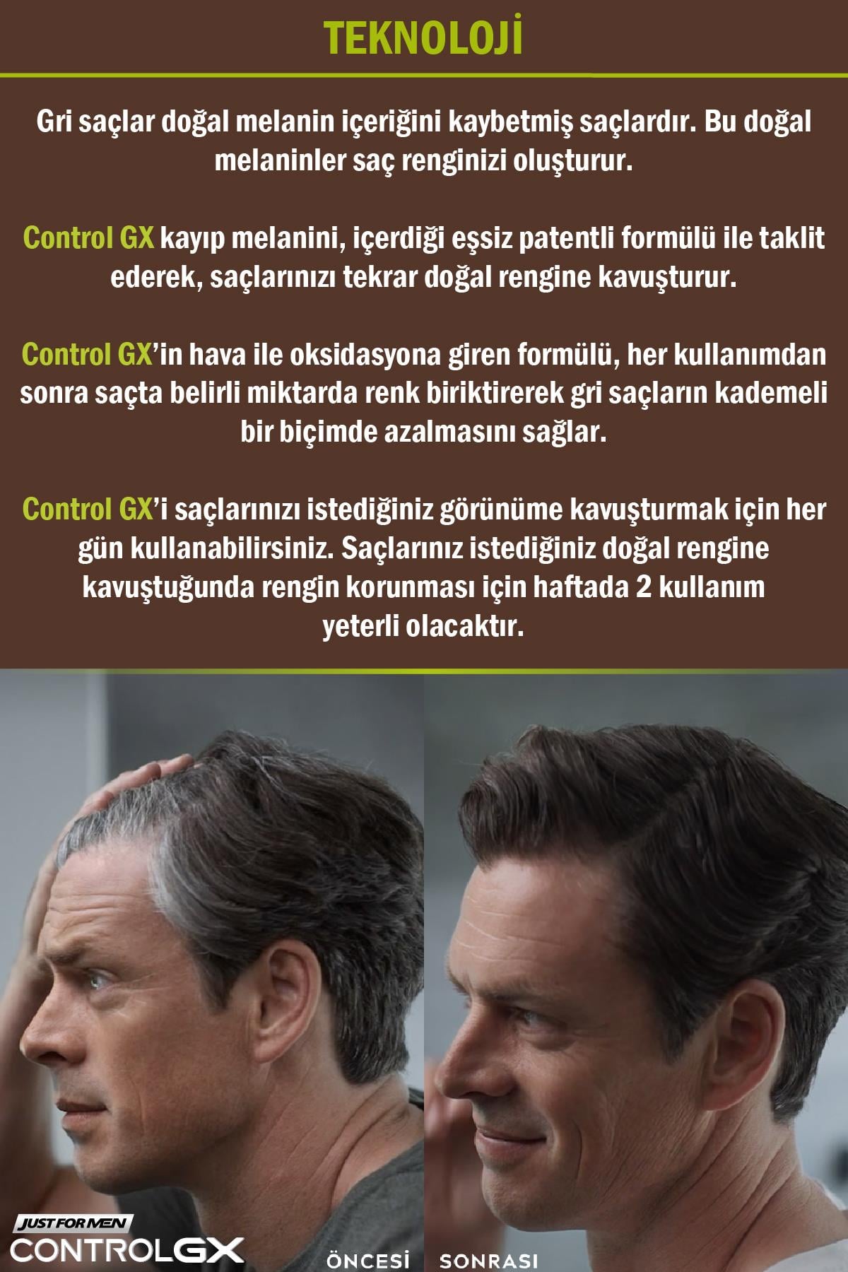 Control GX Saç Gri Azaltıcı Şampuan 2'li Set