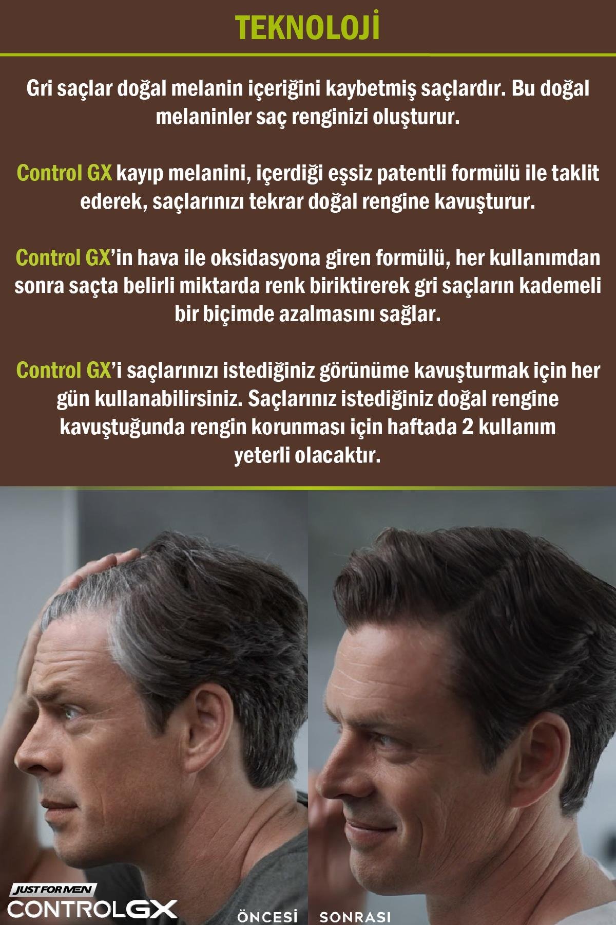 Control GX Saç Gri Azaltıcı Şampuan 3'lü Set