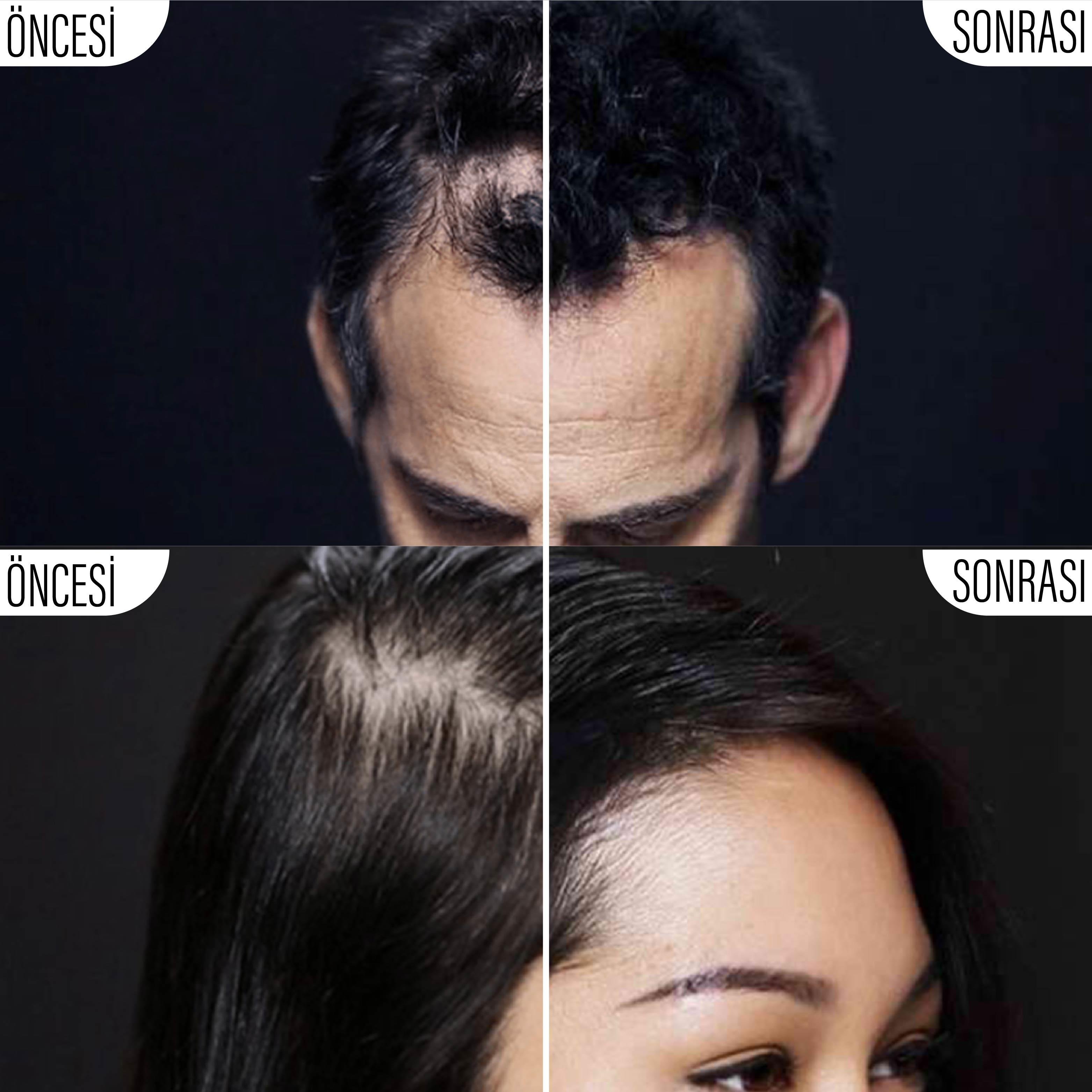 Toppik 12 gr Orta Kahve