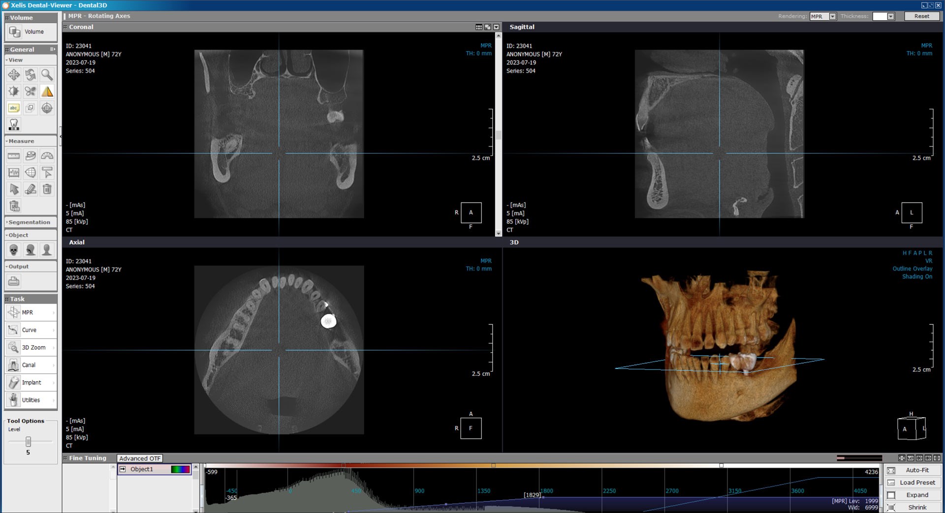 X-VIEW 3D TOMOGRAFİ