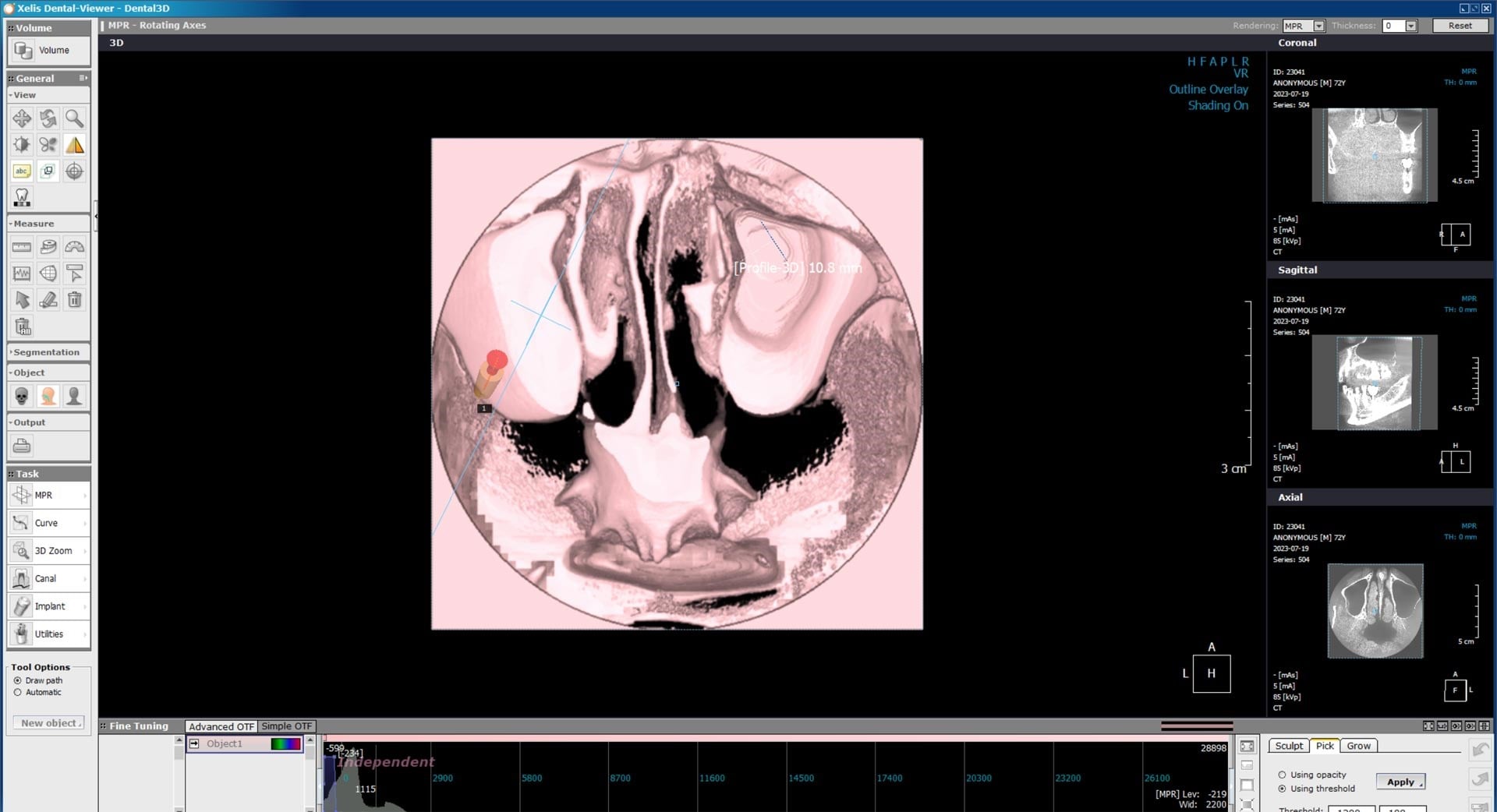 X-VIEW 3D TOMOGRAFİ