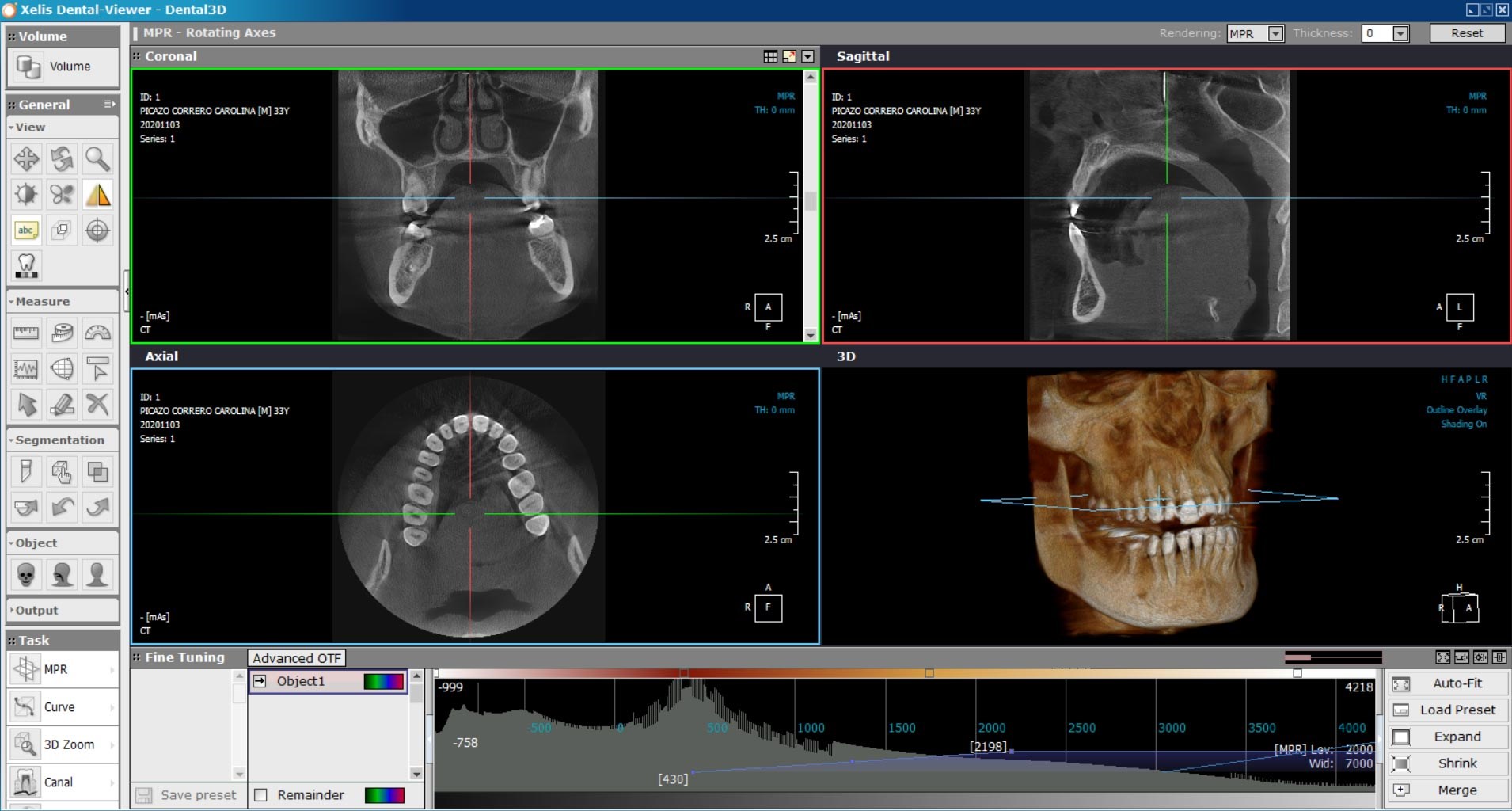X-VIEW 3D TOMOGRAFİ