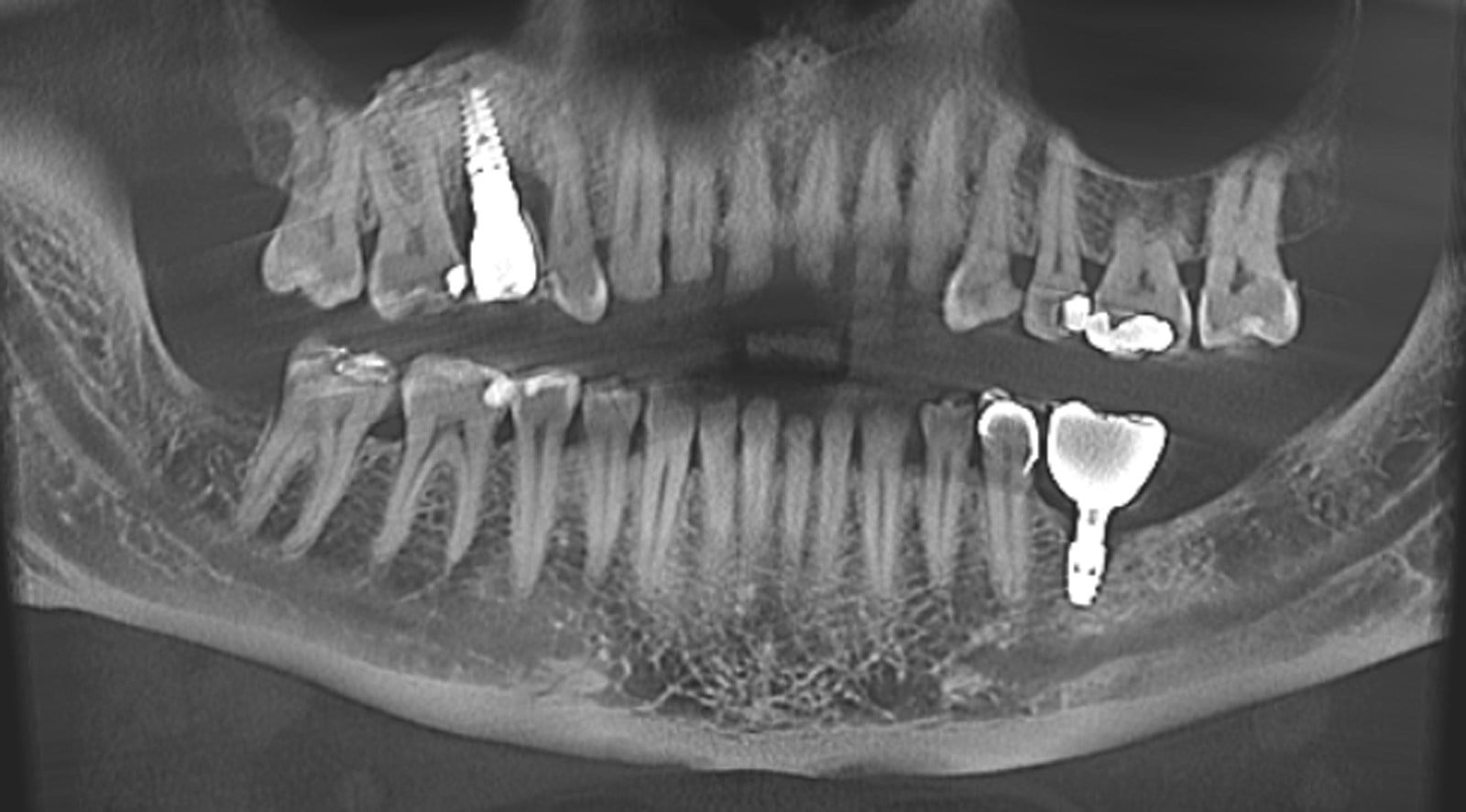 X-VIEW 3D TOMOGRAFİ