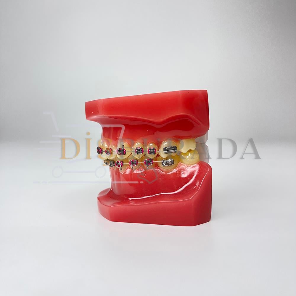 Diamonds Ortodontik Model Diş 2