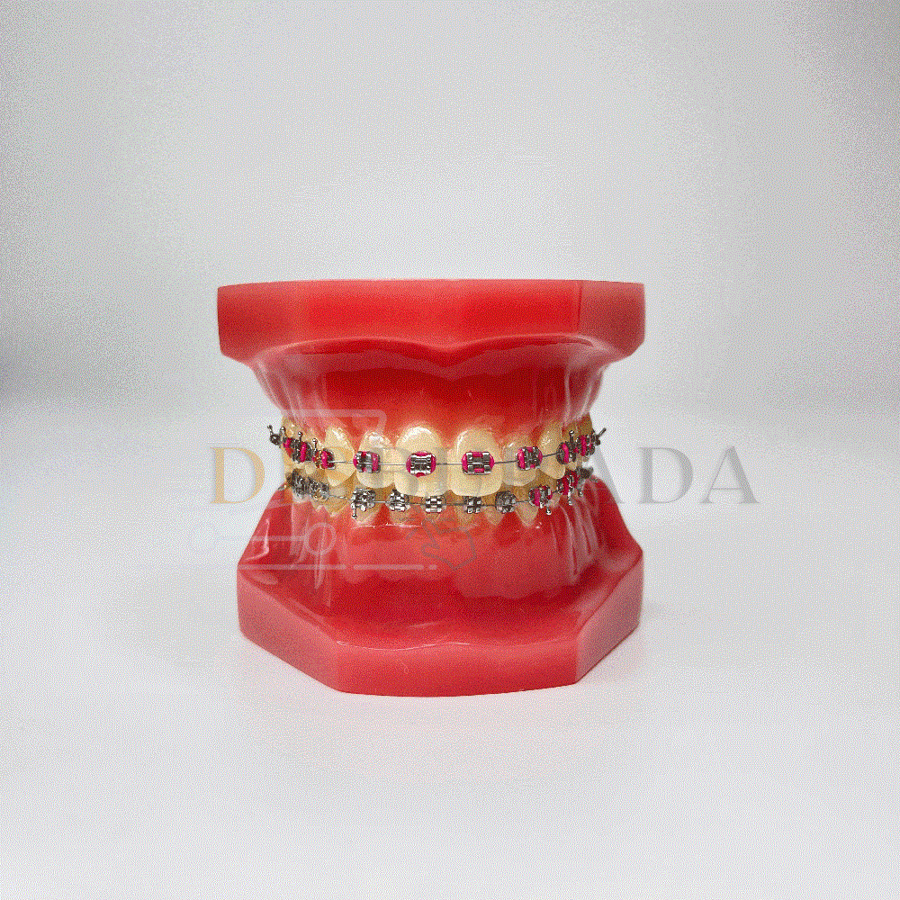 Diamonds Ortodontik Model Diş 2
