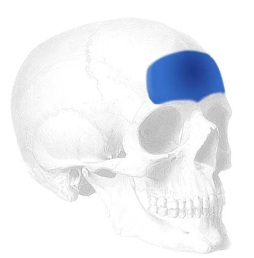 EPTFE Alın İmplantı | EPTFE Forehead