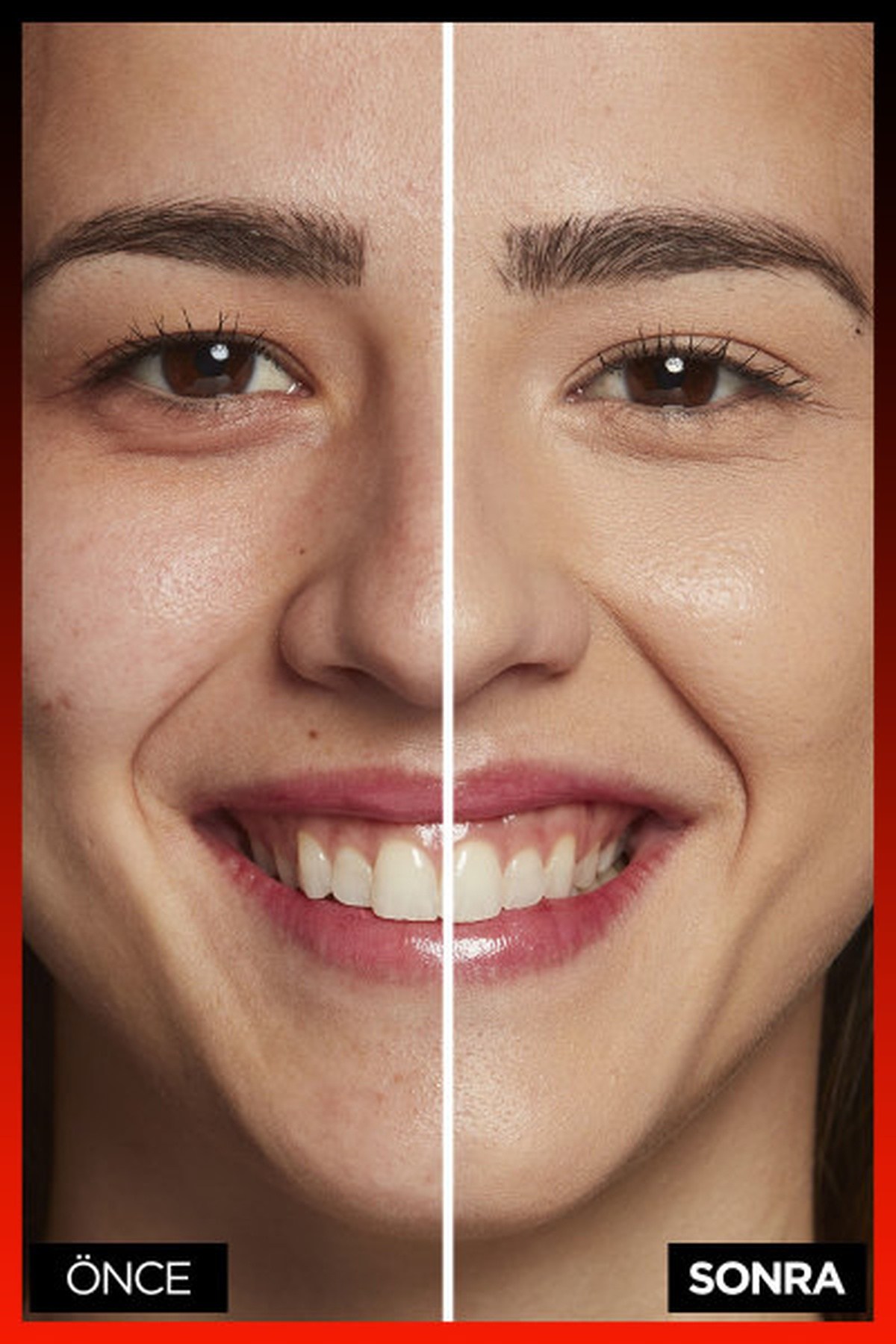 Loreal ParisLoreal Paris Infaillible 24H Tüm Yüze Uygulanabilir Kapatıcı 330 Pecan30173651