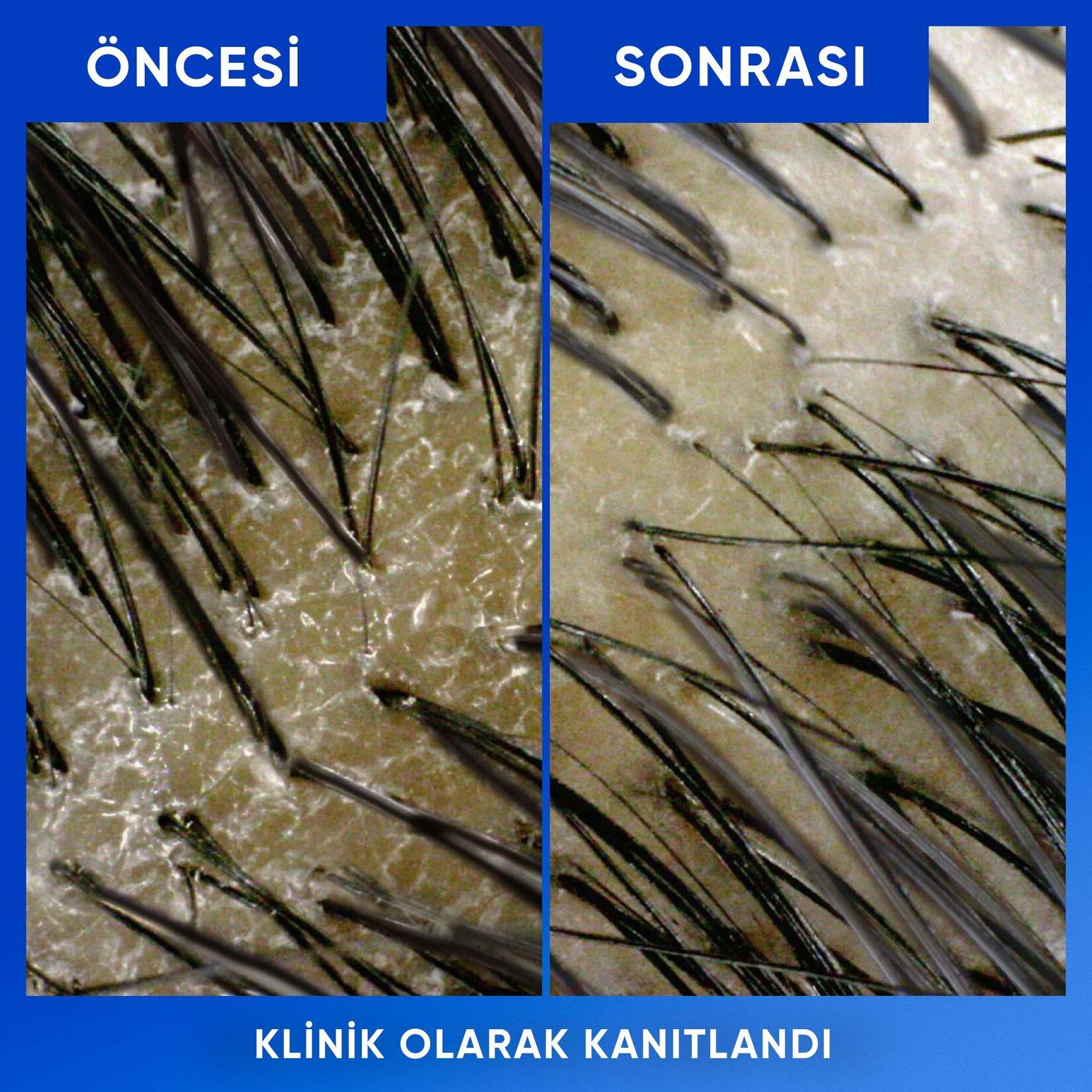 Head&Shoulders Arındırma&Parlaklık Şampuan 330 ml