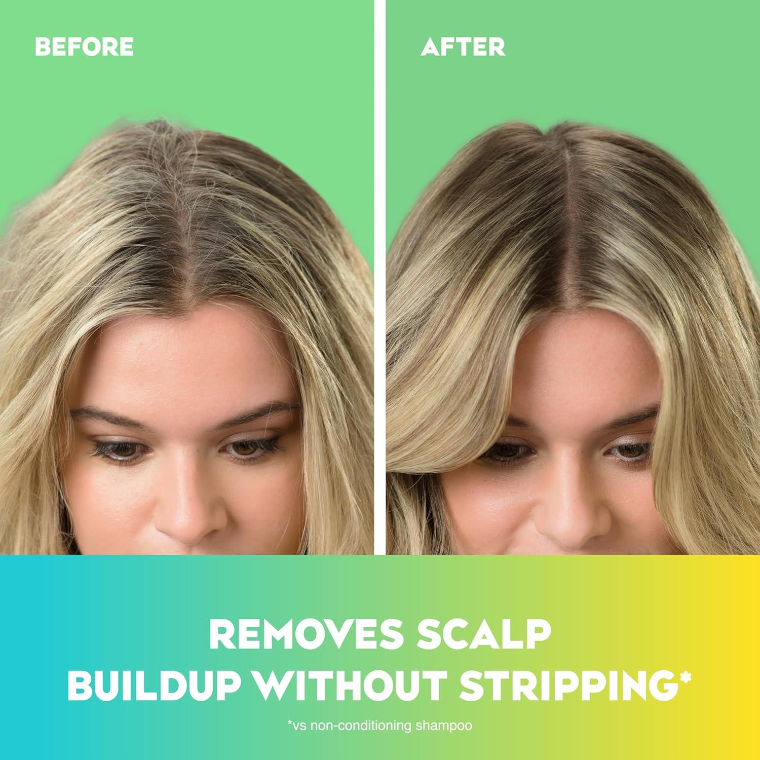 Ogx Extra Strength refreshing scalp+teatree mint Şampuan 385