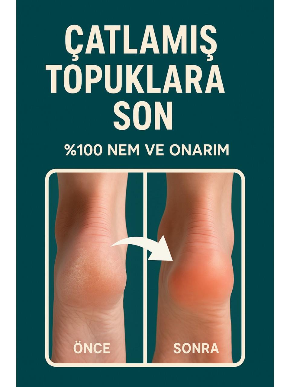 Clinic Topuk Çatlak & Ayak Bakım Kremi 110gr.