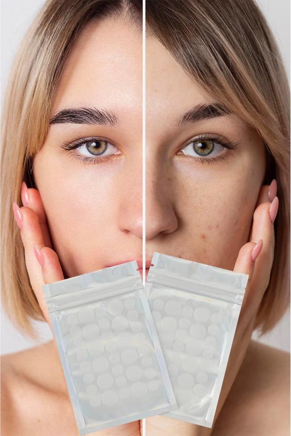 Akne Sivilce Bandı Yaması 72 Adet