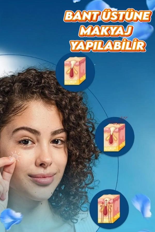Akne Sivilce Siyah Nokta Bandı Pimple Patch 120 Adet
