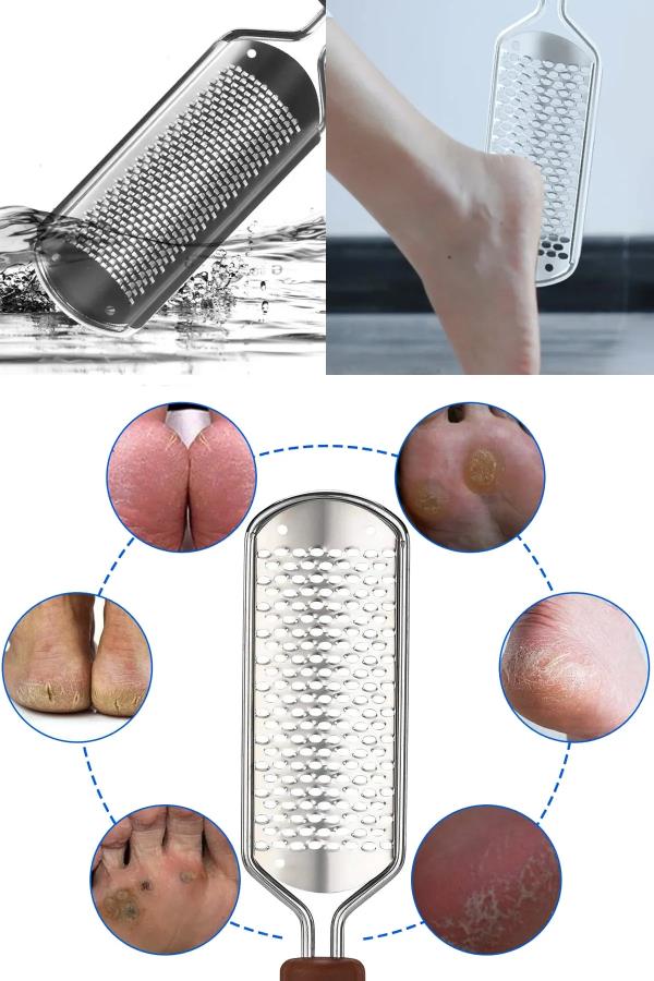 Ayak Topuk Törpüsü XL72