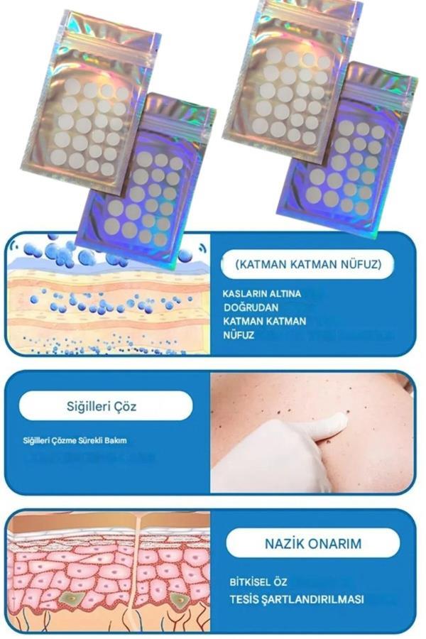 Skin Tag Sıgıl Et Beni Giderici Bant