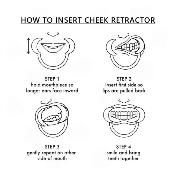 C Ekartör Plastik - Esnek Plastik Ekartör