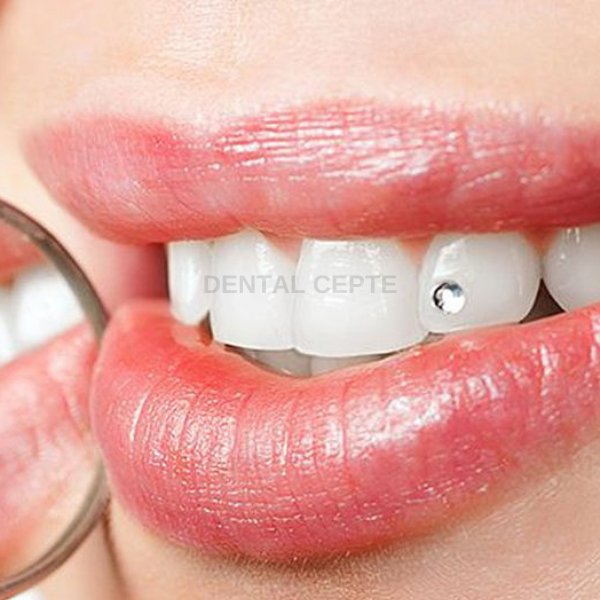 Crisdental Diş Pırlantası 12li Paket 