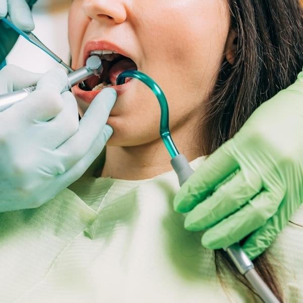 Dental Ünit Cerrahi Sakşın Kauçuk Emme Aparatı 