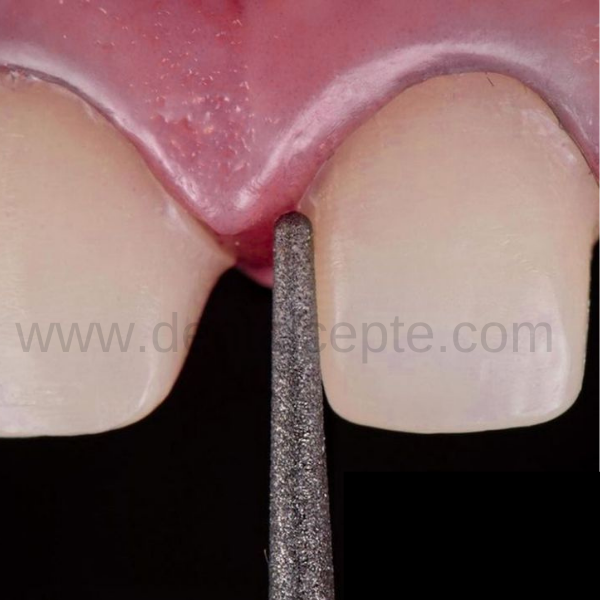 Dimei Aeratör Elmas Chamfer Frezi - Sarı