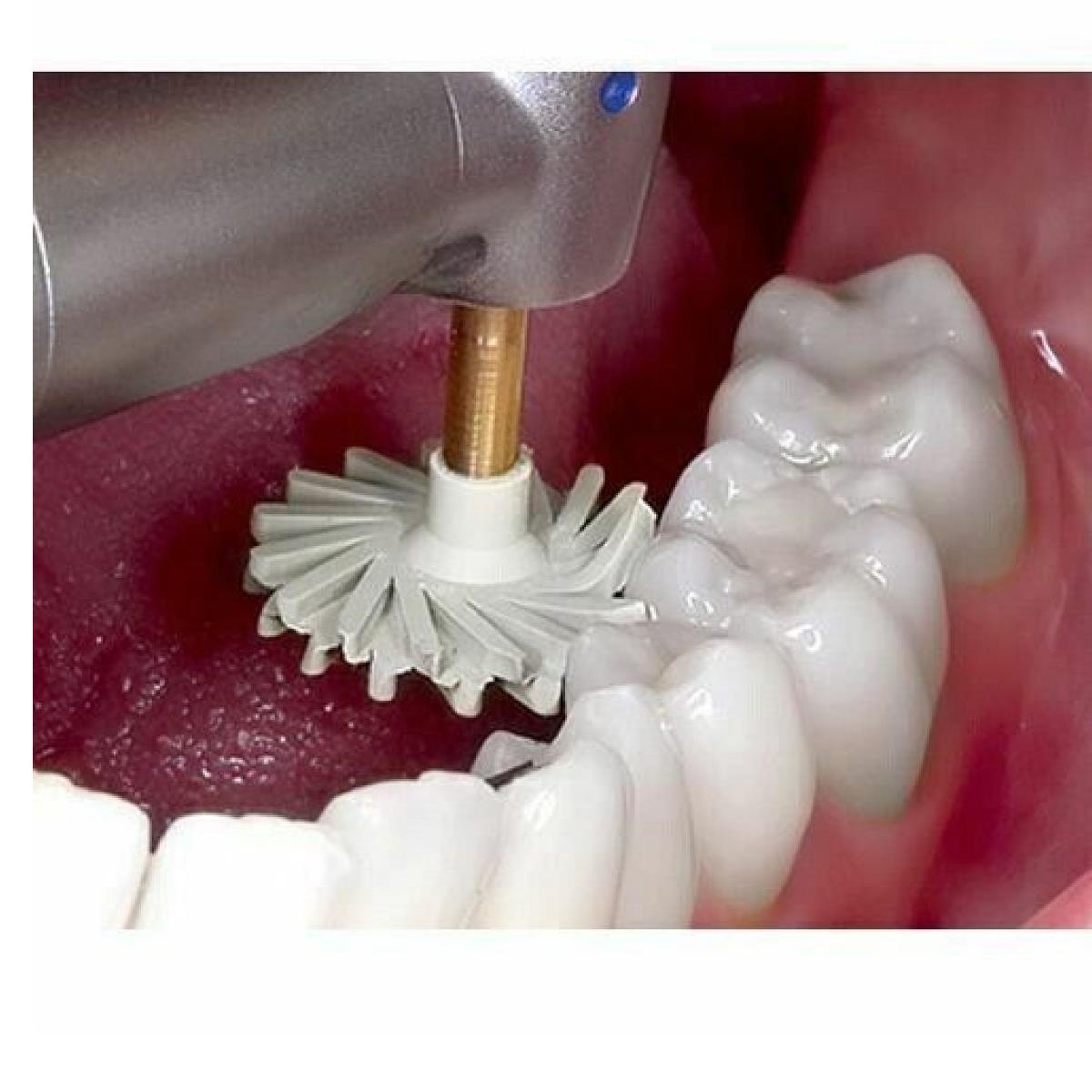 Eve Dental Diapro Twist RA 363 EMax Dental Porselen -Seramik Parlatma Elmas Spiral Elmas Cila Lastiği 6'lı