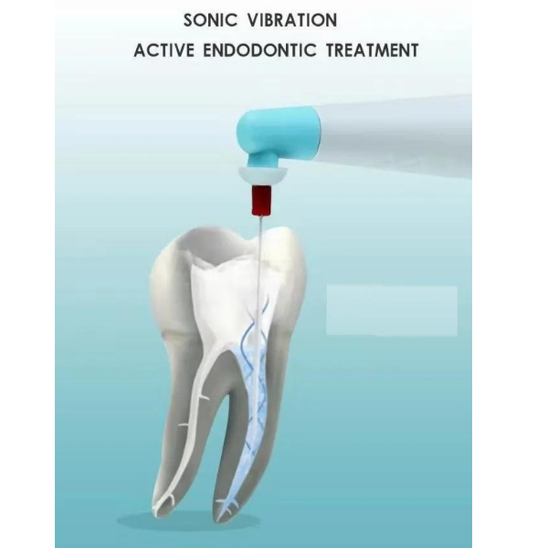 G-Force Sonic Endo Aktivatör İrigasyon Cihazı (60 Yedek Uç Ücretsiz)