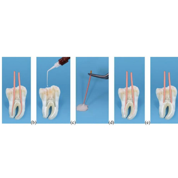 Meta Biomed Ceraseal  Bioseramik esaslı Kanal Dolgu Patı