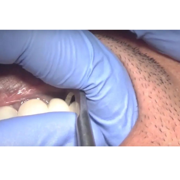 Otomatik Kron Sökücü