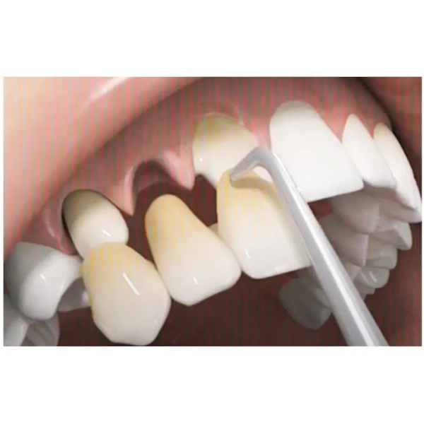 Otomatik Kron Sökücü