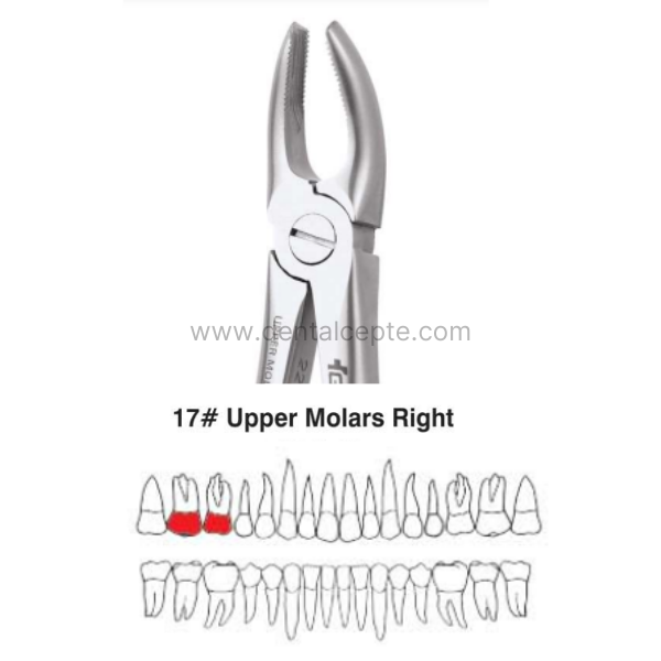 Perfect Üst Molar Sağ Kök Davyesi Fig.17