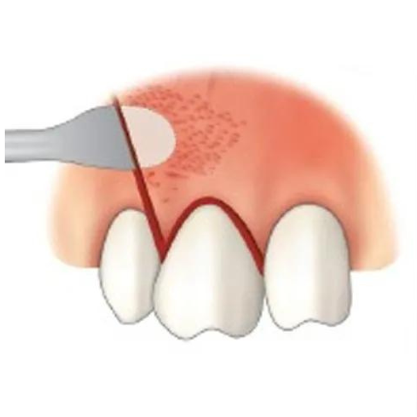 Perios Elavatörü No:9 (9/108 )
