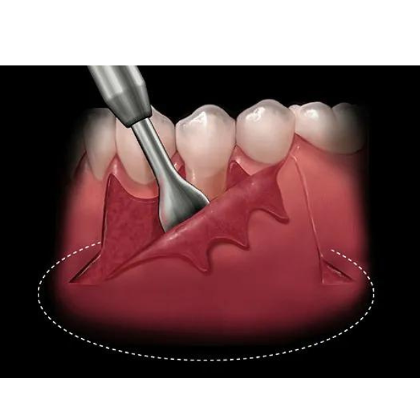 Perios Elavatörü No:9 (9/108 )