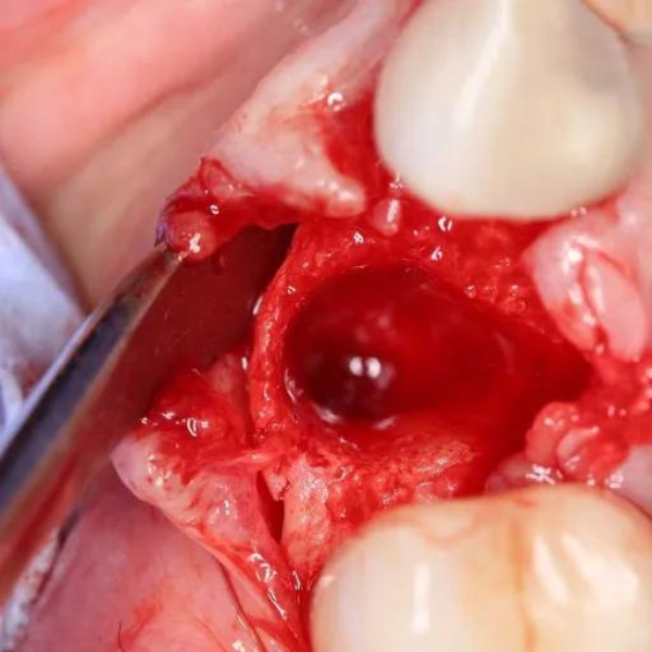 Perios Elavatörü No:9 (9/108 )