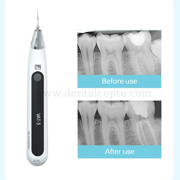 Refine VAT-3 Endo Aktivatör