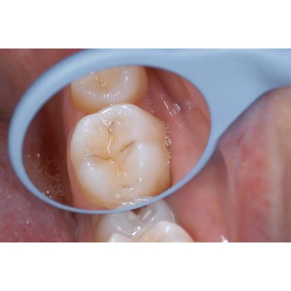 Relax Rodyum Ayna 10'lu Paket