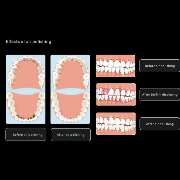 Woodpecker DTE AP-H Airflow Cihazı
