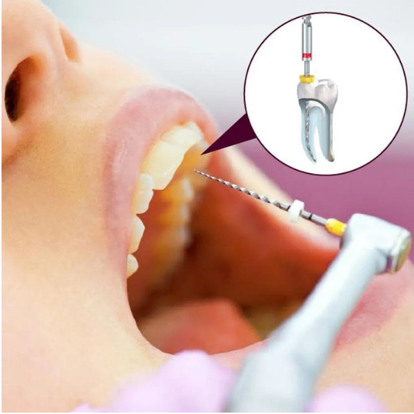 Woodpecker Endopace Endomotor (Resiproc ve Rotary Mod )